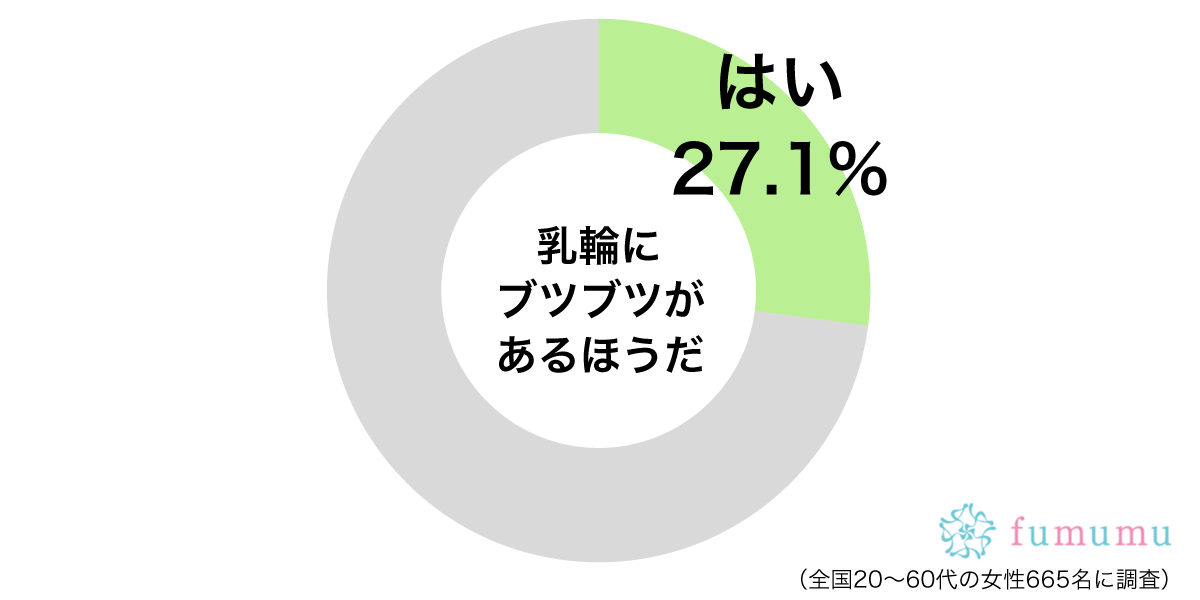 誰にも言えないおっぱいの悩みu2026「乳輪のブツブツ」正体は何？ u2013 fumumu