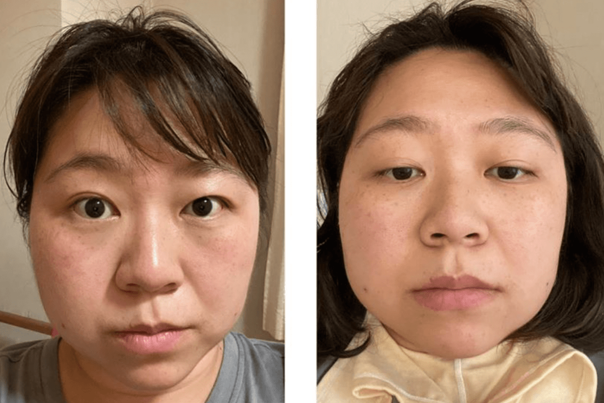 やしろ優 全身麻酔の手術を報告 御飯食べるのも苦労 Fumumu